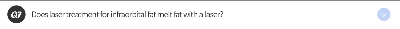 눈밑지방 레이저 치료는 레이저로 지방을 녹이는건가요?